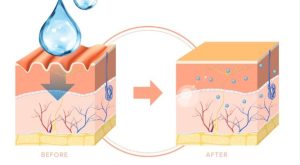 سرم لاک اسمیت